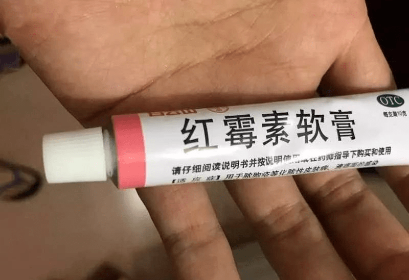 红霉素擦脸使用天数解析