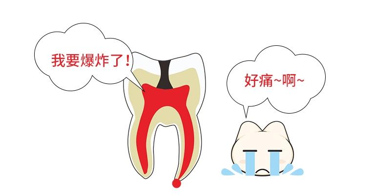 深度解析龋齿成因及防治策略，成因深度解析与防治策略