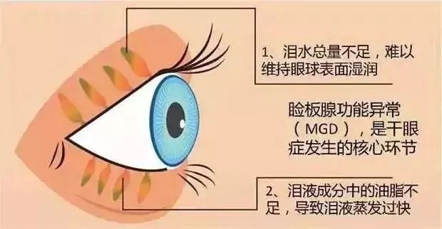 每次眨眼的微妙修复，泪膜的自我疗愈力量