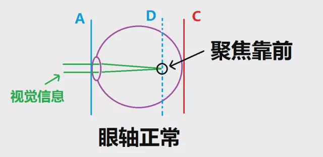 探究迎太阳闭眼预防近视背后的原理，北大人民医院医生的建议是否真实有效？